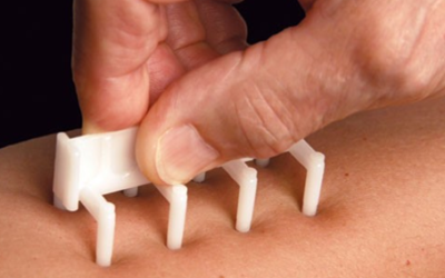 NEW Skin Allergy Tests, The Best Tool for the Integrative and Functional Practitioner